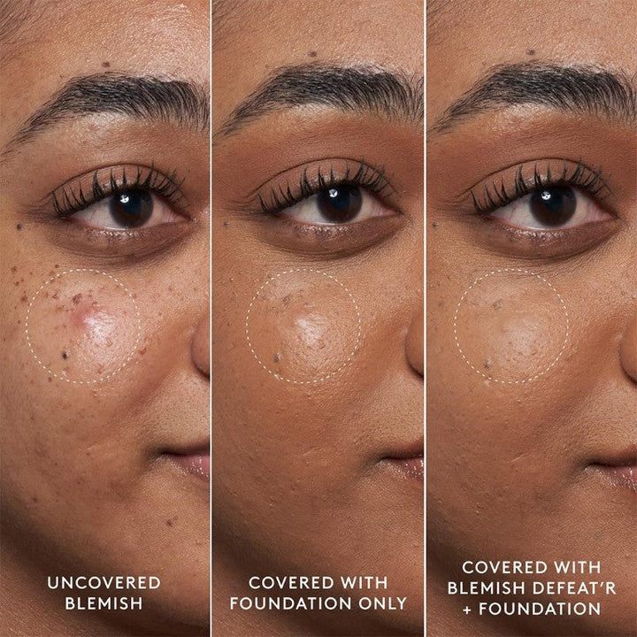 Fenty Skin Blemish Defeat’r BHA Spot-Targeting Gel
