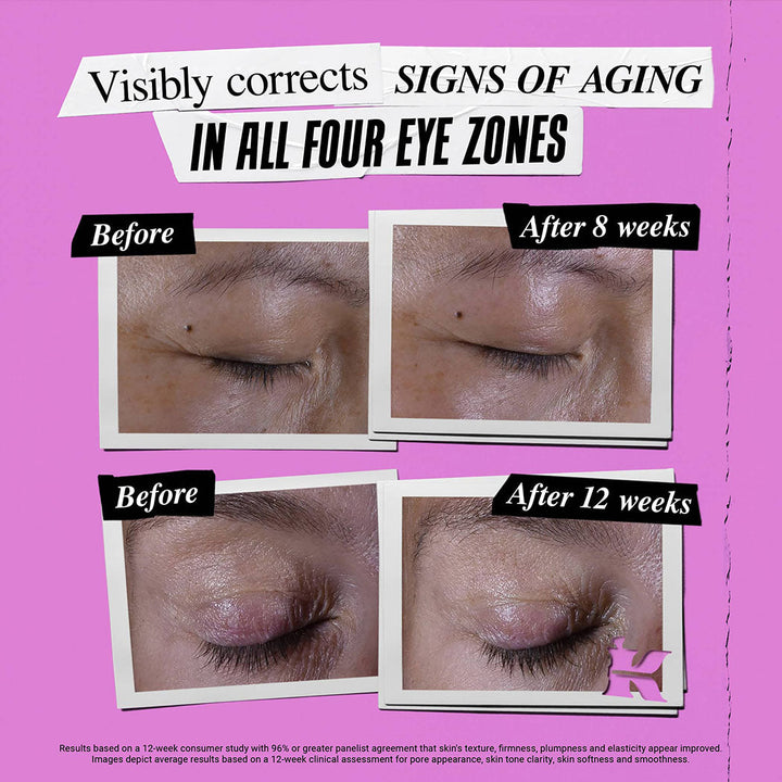 Kiehl's Super Multi Eye Zone Treatment