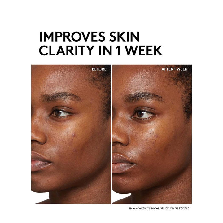 Fenty Skin Barbados Cherry Brightening Pore & Oil-Control Toner