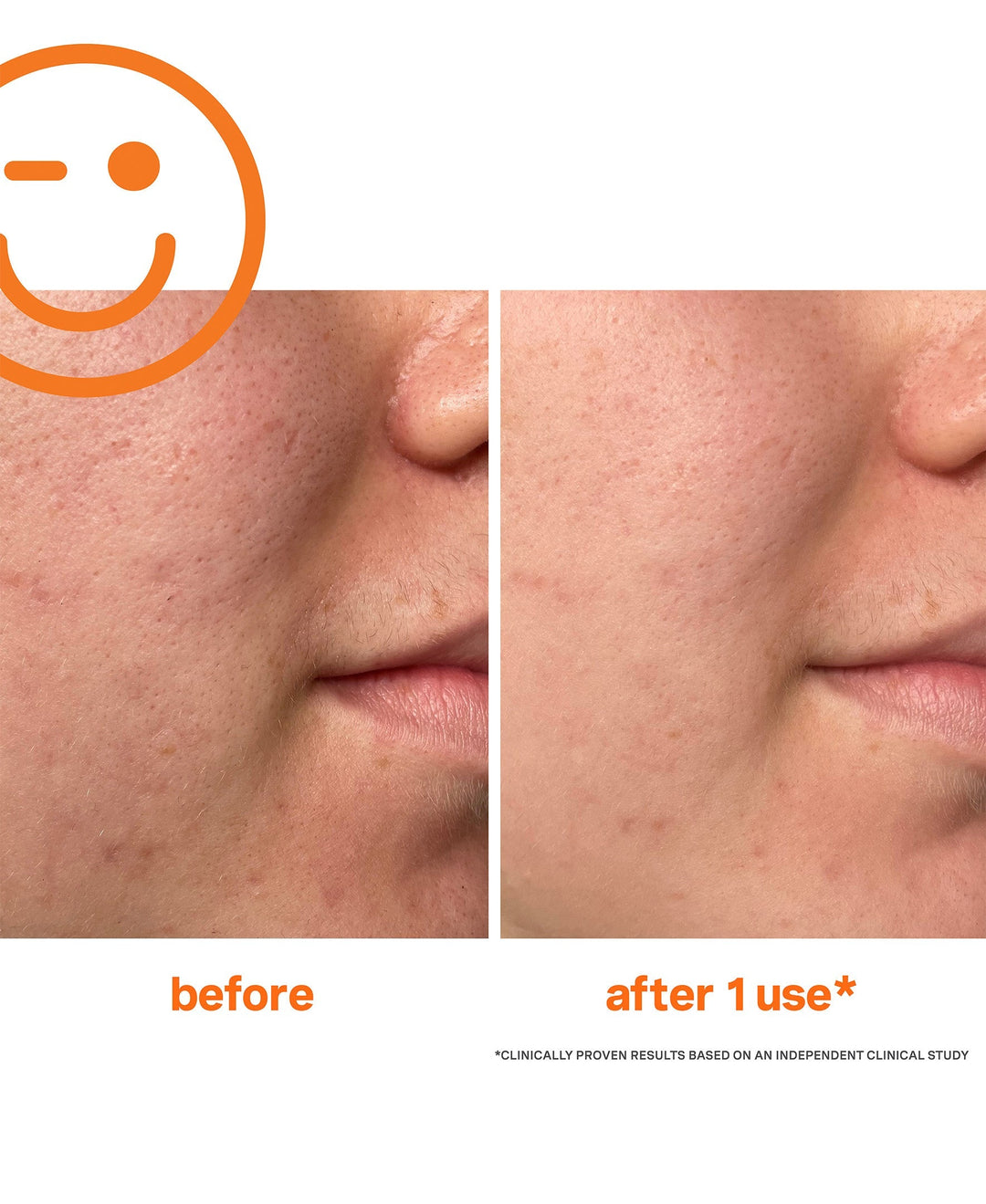 Kate Somerville ExfoliKate Intensive Exfoliating Treatment 60ml