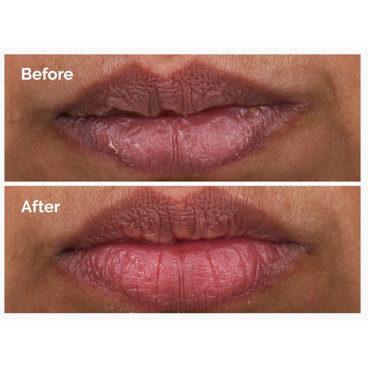 The Ordinary PHA 5% Exfoliating Lip Serum 15ml