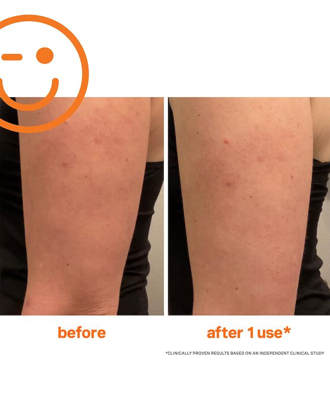 Kate Somerville ExfoliKate Resurfacing Body Scrub 150ml