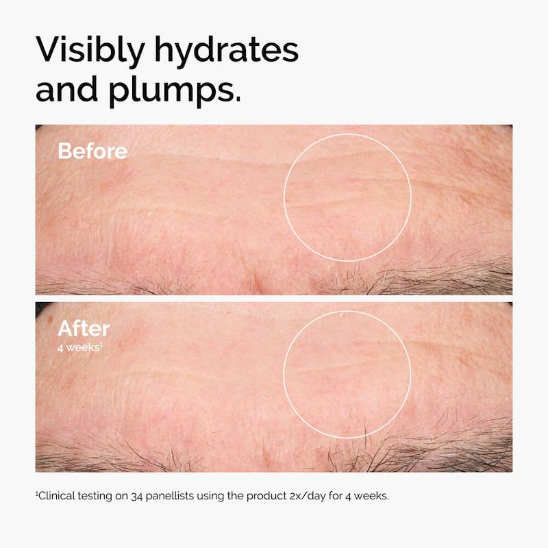 The Ordinary Hyaluronic Acid 2% + B5 Hydrating Serum