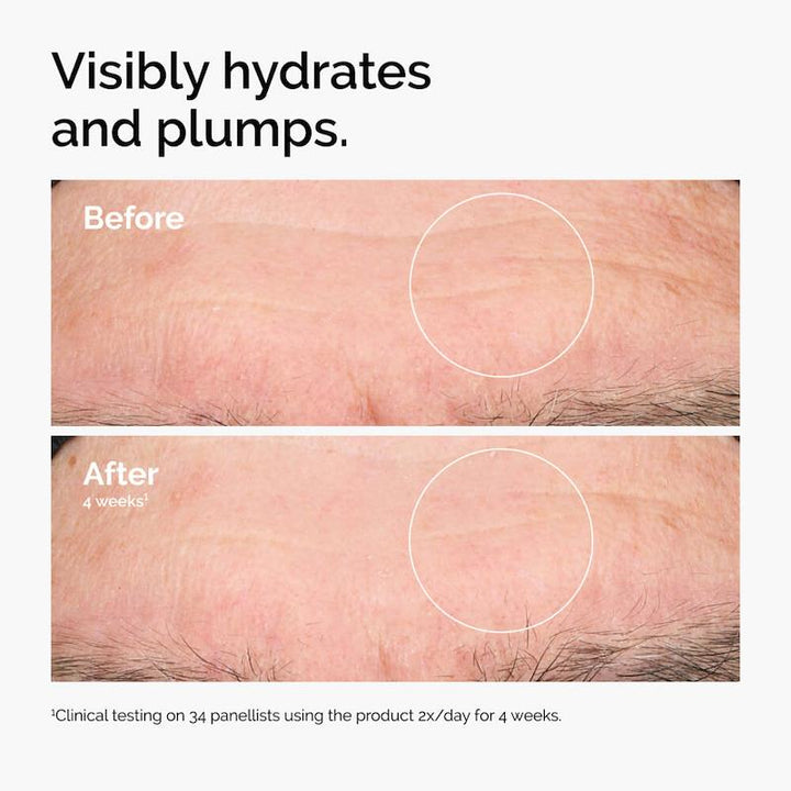 The Ordinary Hyaluronic Acid 2% + B5 Hydrating Serum