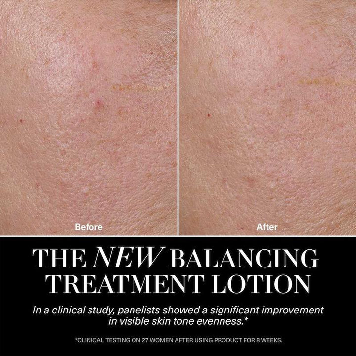 La Mer The Balancing Treatment Lotion 150ml Oily Skin